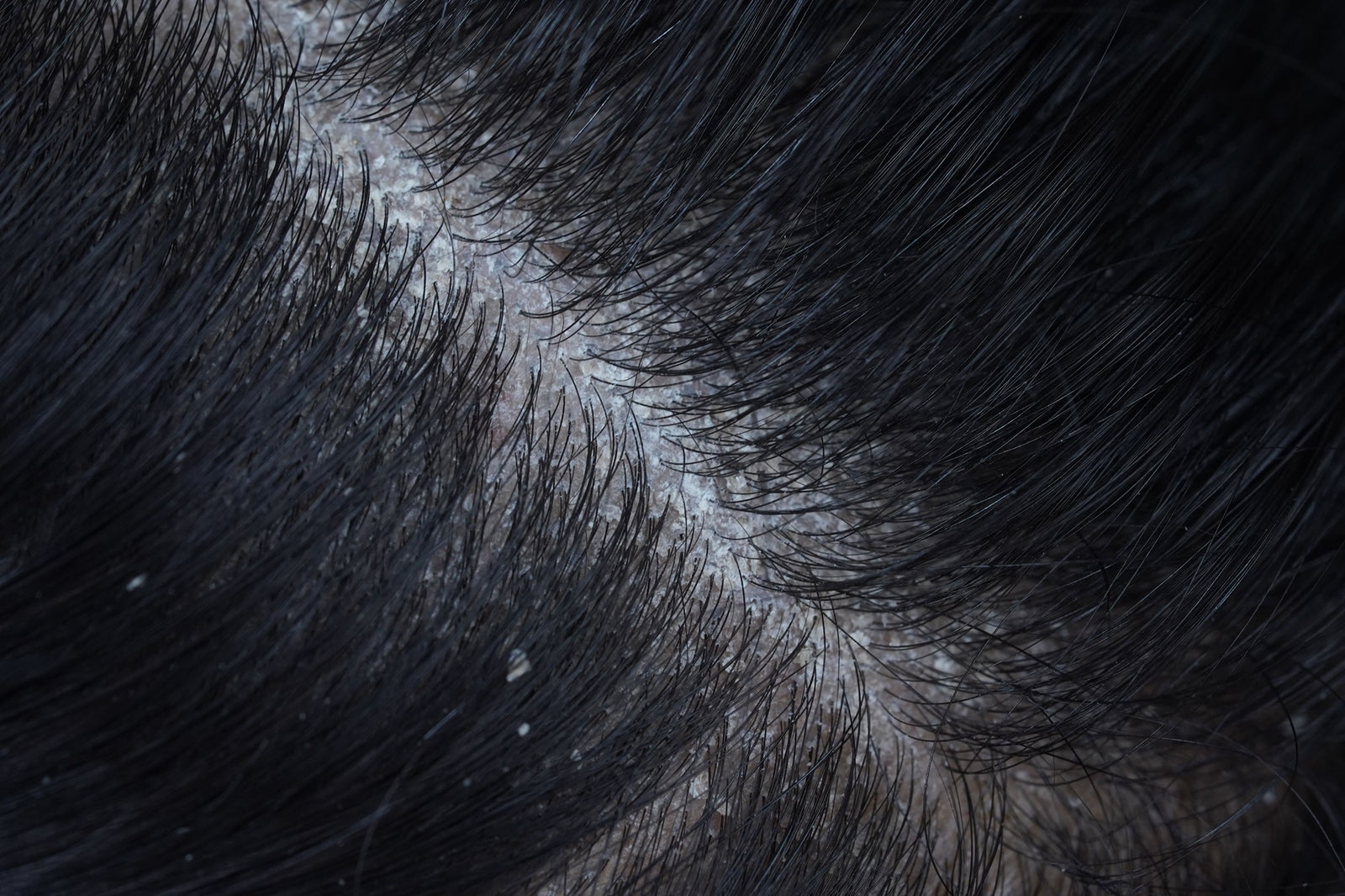 shop with Anti-Dandruff
