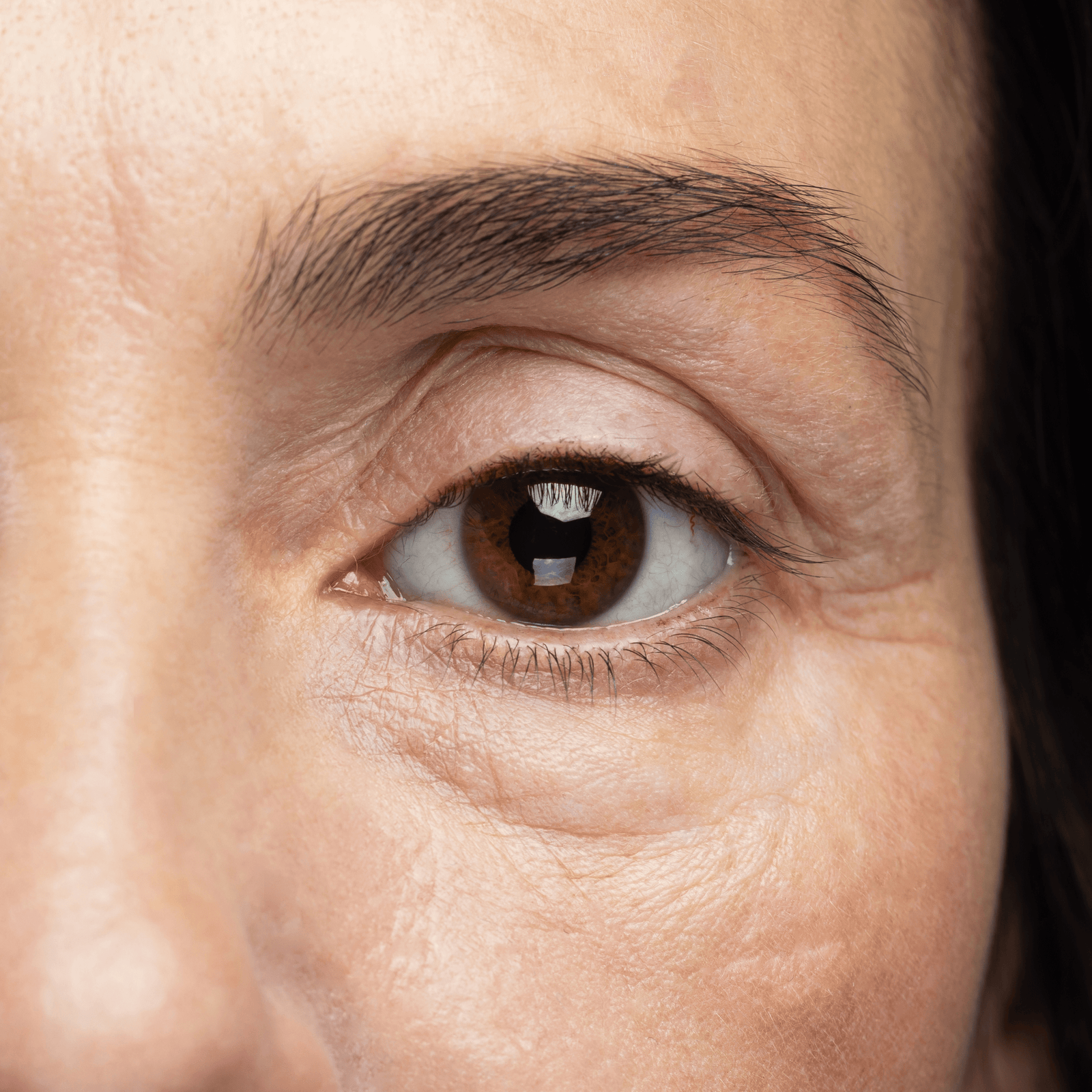 shop with Fine Lines / Wrinkles
